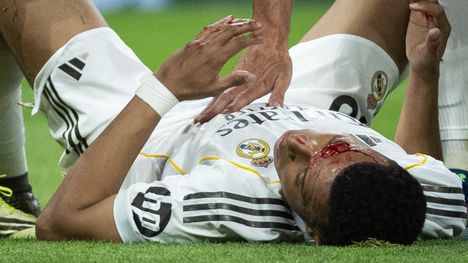 Kylian Mbappe valmistautui intensiivisesti – valmentaja hämmästynyt: "En voi käsittää" 1
