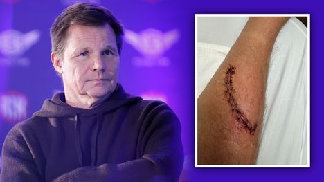 Mika Salo puhui puukotuksestaan – järkyttävät kuvat julkaistu 2 Mika Salo puhui puukotuksestaan – järkyttävät kuvat julkaistu 1