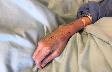 Valmistautuminen kuolemaan vuodeosastolla – isälläni oli viikko aikaa 3