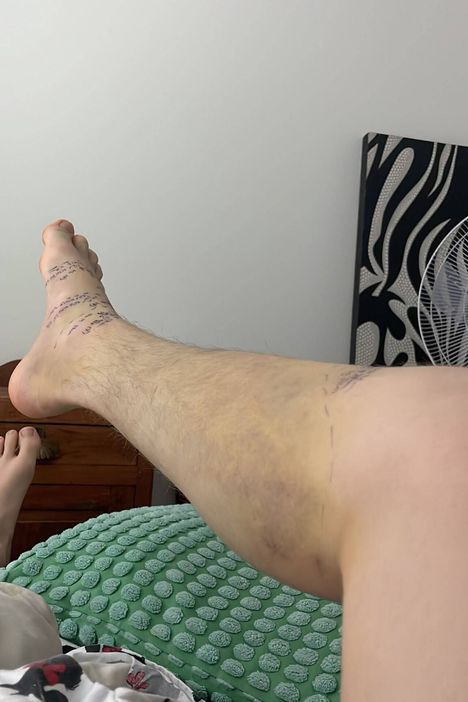 Pekka, 15, koki kovan kohtalon kyy-iskussa 7