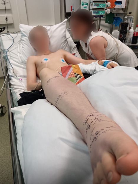 Pekka, 15, koki kovan kohtalon kyy-iskussa 5