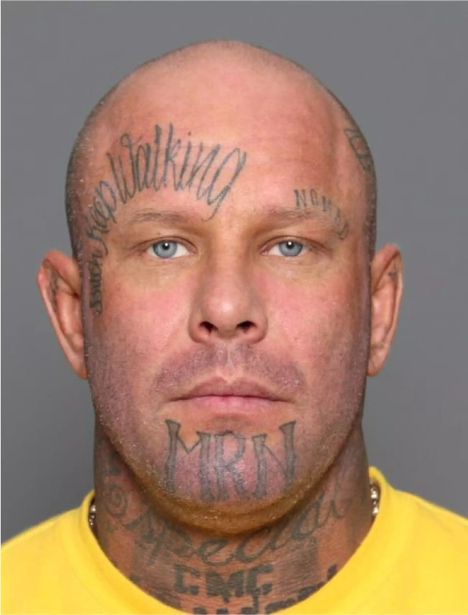 Janne ”Nacci” Tranberg teki rikosilmoituksen Plastic Surgery Centeristä 4 Janne ”Nacci” Tranberg teki rikosilmoituksen Plastic Surgery Centeristä 3
