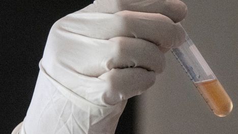 HS: 33-vuotias Karoliina pakasti munasolunsa – toimenpide maksoi noin 7 000 euroa 1